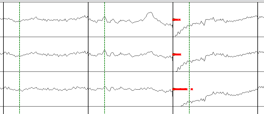 1. Electronics Module Artifact