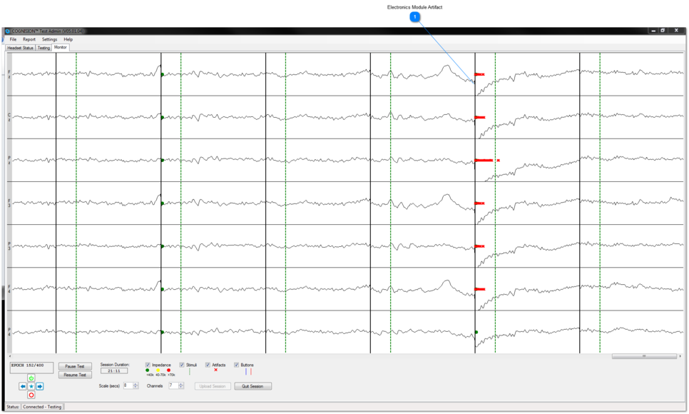 Electronics Module Touching Back of Patient or Chair