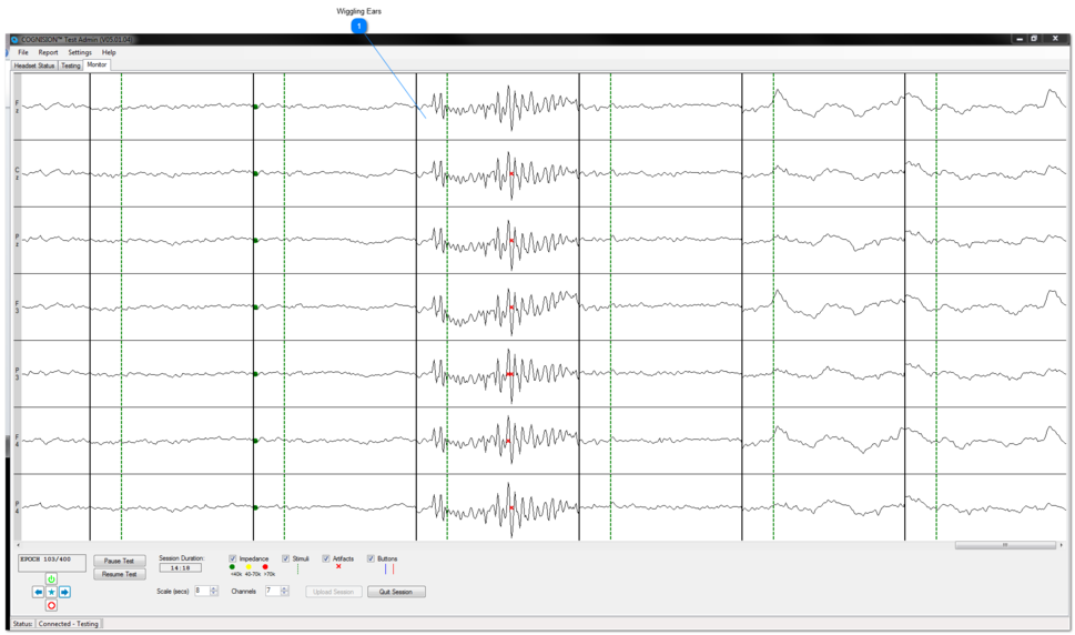 Flexing Ears/Side of Face