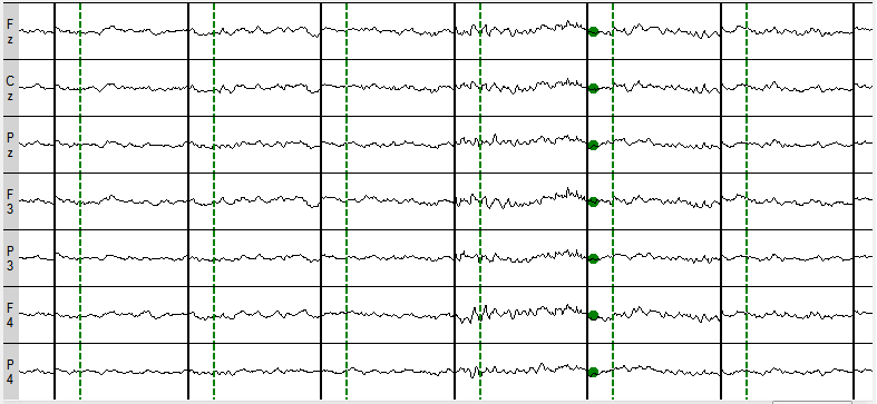 1. Monitor Data Stream