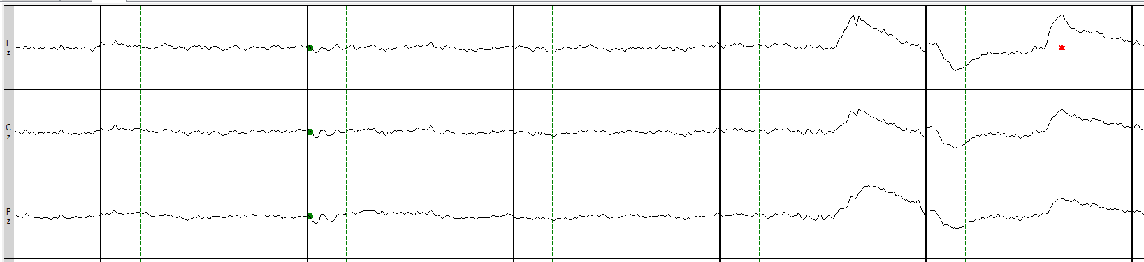 1. Eyes Moving Up and Down