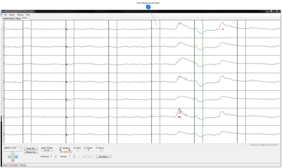 Moving Eyes Up and Down