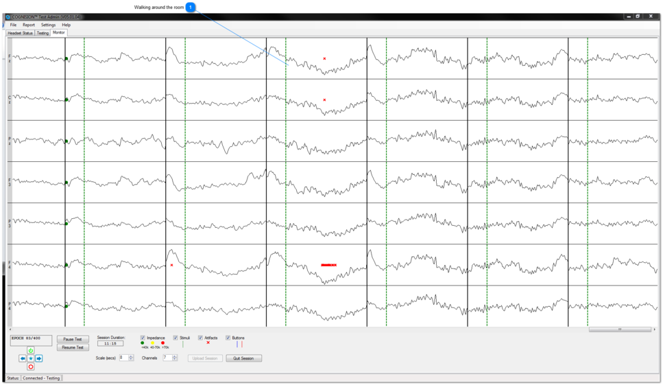 Patient Walking Around the Room